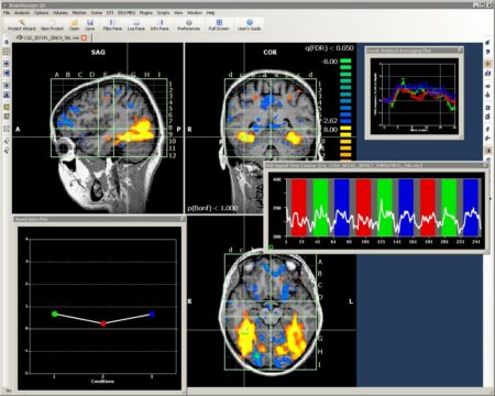 NEUROMARKETING: Imagerie cerveau