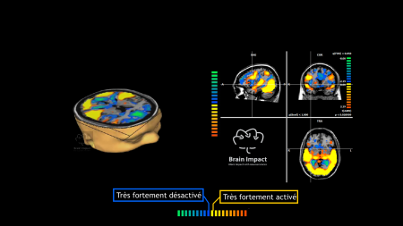 NEUROMARKETING: Imagerie cerveau 3D